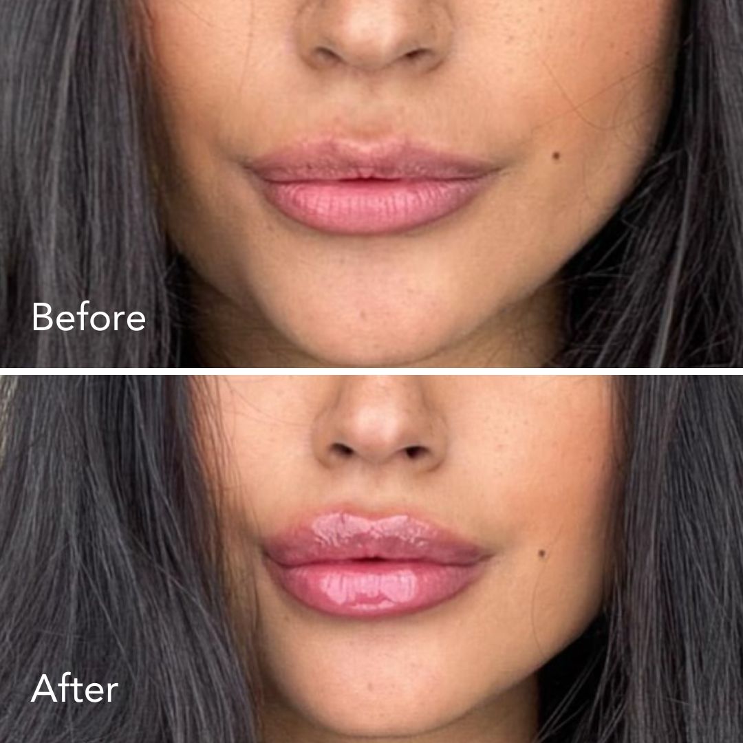Voluluxe Lip Plumper