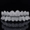 Luxora™ Custom Grillz